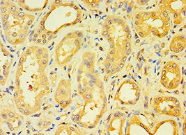 Immunohistochemistry of paraffin-embedded human kidney tissue using ENTPD5 Antibody at dilution of 1:100Rabbit anti-Human ENTPD5 Polyclonal Antibody