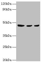 Western blot | All lanes: ENTPD5 antibody at 4μg/ml | Lane 1: Mouse liver tissue | Lane 2: Mouse kidney tissue | Lane 3: Mouse gonad tissue | Secondary | Goat polyclonal to rabbit IgG at 1/10000 dilution | Predicted band size: 48 kDa | Observed band size: 48 kDaRabbit anti-Human ENTPD5 Polyclonal Antibody
