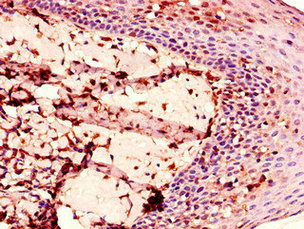 Immunohistochemistry of paraffin-embedded human tonsil tissue using ENTPD8 Antibody at dilution of 1:100Rabbit anti-Human ENTPD8 Polyclonal Antibody