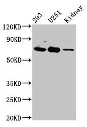 Western Blot  | Positive WB detected in: 293 whole cell lysate, U251 whole cell lysate, Rat kidney tissue  | All lanes: EOMES antibody at 4.5µg/ml  | Secondary  | Goat polyclonal to rabbit IgG at 1/50000 dilution  | Predicted band size: 73, 48, 46, 75 kDa  | Observed band size: 73 kDaRabbit anti-Human EOMES Polyclonal Antibody