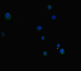 Immunofluorescent analysis of MCF-7 cells using EP300 Antibody at dilution of 1: 100 and Alexa Fluor 488-congugated AffiniPure Goat Anti-Rabbit IgG(H+L)Rabbit anti-Human EP300 Polyclonal Antibody