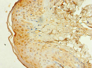 Immunohistochemistry of paraffin-embedded human skin tissue using EP300 Antibody at dilution of 1:100Rabbit anti-Human EP300 Polyclonal Antibody