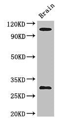Western Blot | Positive WB detected in: Mouse brain tissue | All lanes: EPHA1 antibody at 3μg/ml | Secondary | Goat polyclonal to rabbit IgG at 1/50000 dilution | Predicted band size: 109, 53, 52 kDa | Observed band size: 109, 30 kDa