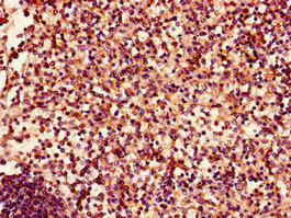 Immunohistochemistry of paraffin-embedded human spleen tissue using the antibody at dilution of 1:100Rabbit anti-Human EPHA4 Polyclonal Antibody