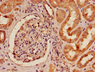 Immunohistochemistry of paraffin-embedded human kidney tissue using EPHA4 Antibody at dilution of 1:100Rabbit anti-Human EPHA4 Polyclonal Antibody