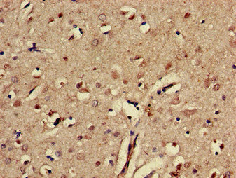 Immunohistochemistry of paraffin-embedded human brain tissue using EPHA5 Antibody at dilution of 1:100Rabbit anti-Human EPHA5 Polyclonal Antibody