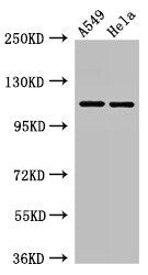 Western Blot  | Positive WB detected in: A549 whole cell lysate, Hela whole cell lysate  | All lanes: EPHA5 antibody at 3µg/ml  | Secondary  | Goat polyclonal to rabbit IgG at 1/50000 dilution  | Predicted band size: 115, 113, 108 kDa  | Observed band size: 115 kDaRabbit anti-Human EPHA5 Polyclonal Antibody