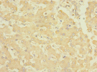 Immunohistochemistry of paraffin-embedded human liver tissue using EPHB4 Antibody at dilution of 1:100Rabbit anti-Human EPHB4 Polyclonal Antibody