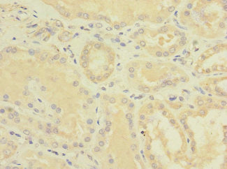 Immunohistochemistry of paraffin-embedded human kidney tissue using EPHB4 Antibody at dilution of 1:100Rabbit anti-Human EPHB4 Polyclonal Antibody