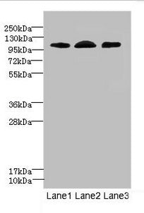 Western blot | All lanes: EPHB4 antibody at 2.71μg/ml | Lane 1: A549 whole cell lysate | Lane 2: 293T whole cell lysate | Lane 3: Hela whole cell lysate | Secondary | Goat polyclonal to rabbit IgG at 1/10000 dilution | Predicted band size: 109, 56, 34, 46 kDa | Observed band size: 109 kDaRabbit anti-Human EPHB4 Polyclonal Antibody