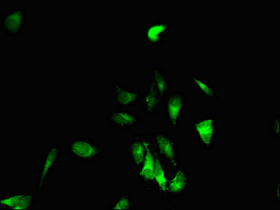 Immunofluorescent analysis of Hela cells using EPHB6 Antibody at dilution of 1:100 and Alexa Fluor 488-congugated AffiniPure Goat Anti-Rabbit IgG(H+L)Rabbit anti-Human EPHB6 Polyclonal Antibody