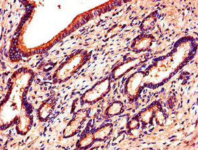 Immunohistochemistry of paraffin-embedded human pancreatic tissue using EPHB6 Antibody at dilution of 1:100Rabbit anti-Human EPHB6 Polyclonal Antibody