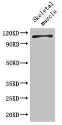 Western Blot | Positive WB detected in: Mouse skeletal muscle tissue | All lanes: EPHB6 antibody at 2μg/ml | Secondary | Goat polyclonal to rabbit IgG at 1/50000 dilution | Predicted band size: 111, 82, 58 kDa | Observed band size: 111 kDaRabbit anti-Human EPHB6 Polyclonal Antibody