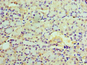 Immunohistochemistry of paraffin-embedded human pancreatic tissue using EPHX1 Antibody at dilution of 1:100Rabbit anti-Human EPHX1 Polyclonal Antibody