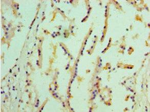 Immunohistochemistry of paraffin-embedded human prostate tissue using EPHX1 Antibody at dilution of 1:100Rabbit anti-Human EPHX1 Polyclonal Antibody