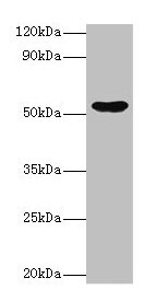 Western blot  | All lanes: EPHX1 antibody at 2µg/ml + Hela whole cell lysate  | Secondary  | Goat polyclonal to rabbit IgG at 1/10000 dilution  | Predicted band size: 53 kDa  | Observed band size: 53 kDaRabbit anti-Human EPHX1 Polyclonal Antibody