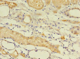 Immunohistochemistry of paraffin-embedded human kidney tissue using EPHX2 Antibody at dilution of 1:100Rabbit anti-Human EPHX2 Polyclonal Antibody