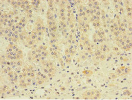 Immunohistochemistry of paraffin-embedded human adrenal gland tissue using EPHX2 Antibody at dilution of 1:100Rabbit anti-Human EPHX2 Polyclonal Antibody