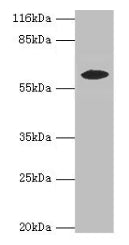 Western blot  | All lanes: EPHX2 antibody at 2µg/ml + MCF-7 whole cell lysate  | Secondary  | Goat polyclonal to rabbit IgG at 1/10000 dilution  | Predicted band size: 63, 58, 56 kDa  | Observed band size: 58 kDaRabbit anti-Human EPHX2 Polyclonal Antibody