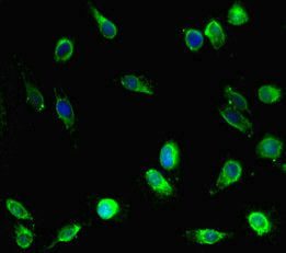 Immunofluorescent analysis of Hela cells using EPM2A Antibody at dilution of 1:100 and Alexa Fluor 488-congugated AffiniPure Goat Anti-Rabbit IgG(H+L)Rabbit anti-Human EPM2A Polyclonal Antibody