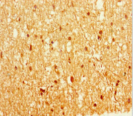 Immunohistochemistry of paraffin-embedded human brain tissue using the antibody at dilution of 1:100Rabbit anti-Human EPM2A Polyclonal Antibody