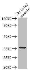 Western Blot  | Positive WB detected in: Mouse skeletal muscle tissue  | All lanes: EPM2A antibody at 3μg/ml  | Secondary  | Goat polyclonal to rabbit IgG at 1/50000 dilution  | Predicted band size: 36, 38, 16, 25, 10, 21, 23 kDa  | Observed band size: 36 kDaRabbit anti-Human EPM2A Polyclonal Antibody