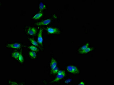 Immunofluorescence staining of Hela cells with EPOR Antibody at 1:133, counter-stained with DAPI. The cells were fixed in 4% formaldehyde, permeabilized using 0.2% Triton X-100 and blocked in 10% normal Goat Serum. The cells were then incubated with the antibody overnight at 4°C. The secondary antibody was Alexa Fluor 488-congugated AffiniPure Goat Anti-Rabbit IgG(H+L).Rabbit anti-Human EPOR Polyclonal Antibody