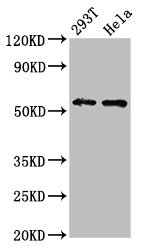 Western Blot | Positive WB detected in: 293T whole cell lysate, Hela whole cell lysate | All lanes: EPOR antibody at 4.3μg/ml | Secondary | Goat polyclonal to rabbit IgG at 1/50000 dilution | Predicted band size: 56, 27, 36 kDa | Observed band size: 56 kDaRabbit anti-Human EPOR Polyclonal Antibody