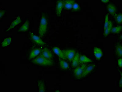 Immunofluorescence staining of Hela cells with EPRS Antibody at 1:200, counter-stained with DAPI. The cells were fixed in 4% formaldehyde, permeabilized using 0.2% Triton X-100 and blocked in 10% normal Goat Serum. The cells were then incubated with the antibody overnight at 4°C. The secondary antibody was Alexa Fluor 488-congugated AffiniPure Goat Anti-Rabbit IgG(H+L).Rabbit anti-Human EPRS Polyclonal Antibody