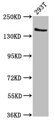 Western Blot | Positive WB detected in: 293T whole cell lysate | All lanes: EPRS antibody at 7.4μg/ml | Secondary | Goat polyclonal to rabbit IgG at 1/50000 dilution | Predicted band size: 171 kDa | Observed band size: 171 kDaRabbit anti-Human EPRS Polyclonal Antibody