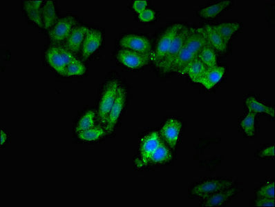 Immunofluorescent analysis of HepG2 cells using ERAP1 Antibody at dilution of 1:100 and Alexa Fluor 488-congugated AffiniPure Goat Anti-Rabbit IgG(H+L)Rabbit anti-Human ERAP1 Polyclonal Antibody