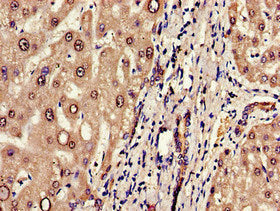 Immunohistochemistry of paraffin-embedded human liver tissue using ERAP1 Antibody at dilution of 1:100Rabbit anti-Human ERAP1 Polyclonal Antibody