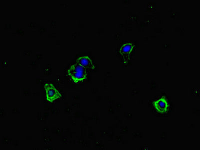 Immunofluorescent analysis of HepG2 cells using ERCC1 Antibody at dilution of 1:100 and Alexa Fluor 488-congugated AffiniPure Goat Anti-Rabbit IgG(H+L)Rabbit anti-Human ERCC1 Polyclonal Antibody