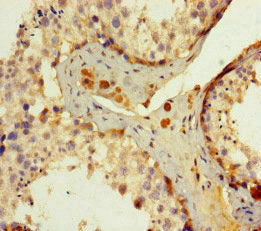 Immunohistochemistry of paraffin-embedded human testis tissue using the antibody at dilution of 1:100Rabbit anti-Human ERCC1 Polyclonal Antibody