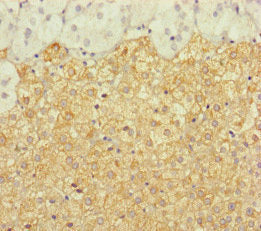 Immunohistochemistry of paraffin-embedded human adrenal gland tissue using ERCC1 Antibody at dilution of 1:100Rabbit anti-Human ERCC1 Polyclonal Antibody