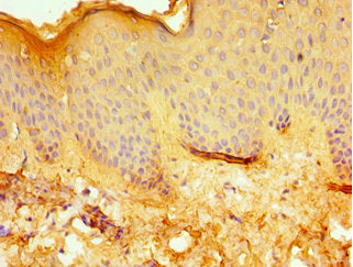Immunohistochemistry of paraffin-embedded human skin tissue using ERCC2 Antibody at dilution of 1:100Rabbit anti-Human ERCC2 Polyclonal Antibody
