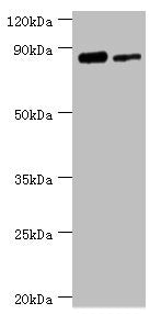 Western blot | All lanes: TFIIH basal transcription factor complex helicase XPD subunit antibody at 2μg/ml | Lane 1: 293T whole cell lysate | Lane 2: K562 whole cell lysate | Secondary | Goat polyclonal to rabbit IgG at 1/10000 dilution | Predicted band size: 87, 47 kDa | Observed band size: 87 kDaRabbit anti-Human ERCC2 Polyclonal Antibody