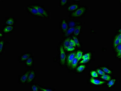 Immunofluorescent analysis of HepG2 cells using TRPM2 Antibody at dilution of 1:100 and Alexa Fluor 488-congugated AffiniPure Goat Anti-Rabbit IgG(H+L)Rabbit anti-Human TRPM2 Polyclonal Antibody