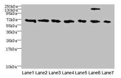 Western blot  | All lanes: TRPM2 antibody at 3µg/ml  | Lane 1: HepG2 whole cell lysate  | Lane 2: Mouse brain tissue  | Lane 3: A549 whole cell lysate  | Lane 4: K562 whole cell lysate  | Lane 5: Mouse kidney tissue  | Lane 6: Human placenta tissue  | Lane 7: Mouse spleen tissue  | Secondary  | Goat polyclonal to rabbit IgG at 1/10000 dilution  | Predicted band size: 172, 166, 96 kDa  | Observed band size: 70 kDaRabbit anti-Human TRPM2 Polyclonal Antibody