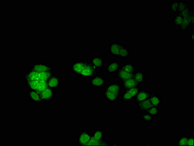 Immunofluorescent analysis of PC-3 cells using ERG Antibody at dilution of 1:100 and Alexa Fluor 488-congugated AffiniPure Goat Anti-Rabbit IgG(H+L)Rabbit anti-Human ERG Polyclonal Antibody