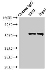 Immunoprecipitating ERG in Rat heart tissue  | Lane 1: Rabbit control IgG (1µg) instead of the antibody in Rat heart tissue. For western blotting, a HRP-conjugated Protein G antibody was used as the secondary antibody (1/2000)  | Lane 2: the antibody (8µg) + Rat heart tissue (500µg)  | Lane 3: Rat heart tissue (10µg)Rabbit anti-Human ERG Polyclonal Antibody