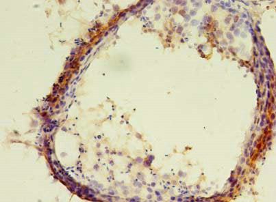 Immunohistochemistry of paraffin-embedded human testis tissue using ERLIN1 Antibody at dilution of 1:100Rabbit anti-Human ERLIN1 Polyclonal Antibody