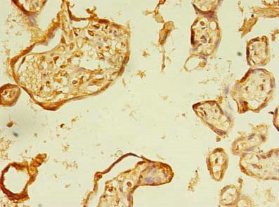 Immunohistochemistry of paraffin-embedded human placenta tissue using ERLIN1 Antibody at dilution of 1:100Rabbit anti-Human ERLIN1 Polyclonal Antibody