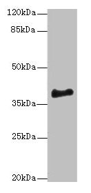 Western blot  | All lanes: ERLIN1 antibody at 4µg/ml + Mouse brain tissue  | Secondary  | Goat polyclonal to rabbit IgG at 1/10000 dilution  | Predicted band size: 39 kDa  | Observed band size: 39 kDaRabbit anti-Human ERLIN1 Polyclonal Antibody