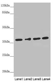 Western blot  | All lanes: ERLIN2 antibody at 3.1µg/ml  | Lane 1: 293T whole cell lysate  | Lane 2: HepG2 whole cell lysate  | Lane 3: U251 whole cell lysate  | Lane 4: Hela whole cell lysate  | Secondary  | Goat polyclonal to rabbit IgG at 1/10000 dilution  | Predicted band size: 38, 17, 23 kDa  | Observed band size: 38 kDaRabbit anti-Human ERLIN2 Polyclonal Antibody