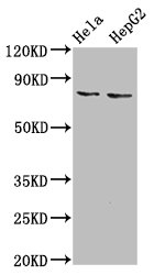 Western Blot  | Positive WB detected in: Hela whole cell lysate, HepG2 whole cell lysate  | All lanes: ESRP2 antibody at 6µg/ml  | Secondary  | Goat polyclonal to rabbit IgG at 1/50000 dilution  | Predicted band size: 79, 78 kDa  | Observed band size: 79 kDaRabbit anti-Human ESRP2 Polyclonal Antibody