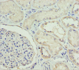 Immunohistochemistry of paraffin-embedded human kidney tissue using ETFA Antibody at dilution of 1:100Rabbit anti-Human ETFA Polyclonal Antibody