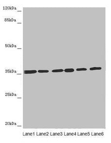 Western blot  | All lanes: ETFA antibody at 4.34µg/ml  | Lane 1: A431 whole cell lysate  | Lane 2: Hela whole cell lysate  | Lane 3: K562 whole cell lysate  | Lane 4: A549 whole cell lysate  | Lane 5: HepG2 whole cell lysate  | Lane 6: MCF-7 whole cell lysate  | Secondary  | Goat polyclonal to rabbit IgG at 1/10000 dilution  | Predicted band size: 36, 31 kDa  | Observed band size: 36 kDaRabbit anti-Human ETFA Polyclonal Antibody