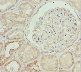 Immunohistochemistry of paraffin-embedded human kidney tissue using ETFA Antibody at dilution of 1:100Rabbit anti-Human ETFA Polyclonal Antibody