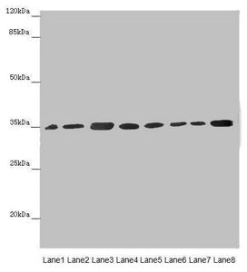 Western blot  | All lanes: ETFA antibody at 2.88µg/ml  | Lane 1: Mouse small intestine tissue  | Lane 2: Mouse liver tissue  | Lane 3: A431 whole cell lysate  | Lane 4: Hela whole cell lysate  | Lane 5: K562 whole cell lysate  | Lane 6: A549 whole cell lysate  | Lane 7: HepG2 whole cell lysate  | Lane 8: MCF-7 whole cell lysate  | Secondary  | Goat polyclonal to rabbit IgG at 1/10000 dilution  | Predicted band size: 36, 31 kDa  | Observed band size: 36 kDaRabbit anti-Human ETFA Polyclonal Antibody